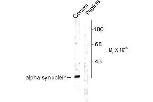 Image no. 1 for anti-Synuclein, alpha (SNCA) (pSer129) antibody (ABIN372588)