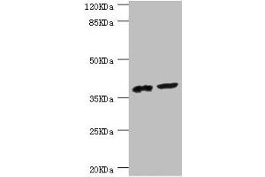 Western blot All lanes: DEDD antibody at 0.