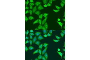 Immunofluorescence analysis of U2OS cells using PKR/PKR/EIF2 antibody (ABIN1679688 and ABIN3018462) at dilution of 1:100. (EIF2AK2 anticorps)