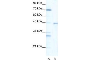 WB Suggested Anti-HSF4 Antibody Titration:  5. (HSF4 anticorps  (Middle Region))