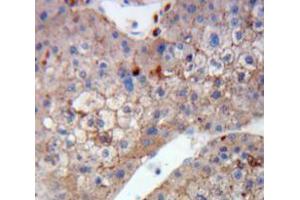 IHC-P analysis of Liver tissue, with DAB staining. (DCT anticorps  (AA 28-263))