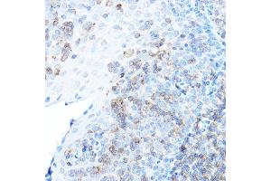 Immunohistochemistry of paraffin-embedded human tonsil using ULBP1 Rabbit pAb (ABIN6128898, ABIN6149917, ABIN6149918 and ABIN6214755) at dilution of 1:500 (40x lens). (ULBP1 anticorps  (AA 26-216))