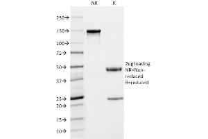 SDS-PAGE Analysis Purified Tryptase Mouse Monoclonal Antibody (TPSAB1/1963). (TPSAB1 anticorps  (AA 115-233))