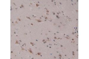 Used in DAB staining on fromalin fixed paraffin- embedded Kidney tissue