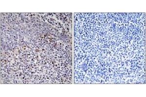 Immunohistochemistry analysis of paraffin-embedded human tonsil tissue, using Cytochrome c-type Heme Lyase Antibody.