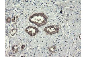 Image no. 2 for anti-Polymerase (RNA) III (DNA Directed) Polypeptide C (62kD) (POLR3C) antibody (ABIN1500340)