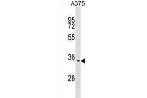 Western Blotting (WB) image for anti-Integral Membrane Protein 2C (ITM2C) antibody (ABIN2999274) (ITM2C anticorps)
