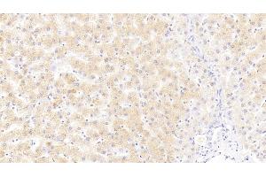 Detection of PLA2G4 in Human Liver Tissue using Polyclonal Antibody to Cytosolic Phospholipase A2 (PLA2G4)
