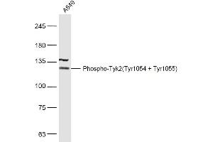 A549 lysates probed with Phospho-Tyk2(Tyr1054 + Tyr1055) Polyclonal Antibody, Unconjugated  at 1:500 dilution and 4˚C overnight incubation.