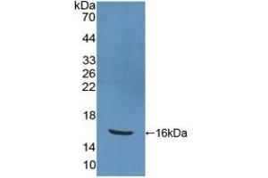 Detection of Recombinant PPARg, Human using Polyclonal Antibody to Peroxisome Proliferator Activated Receptor Gamma (PPARg) (PPARG anticorps  (AA 157-274))