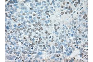 Immunohistochemical staining of paraffin-embedded Kidney tissue using anti-USP13mouse monoclonal antibody. (USP13 anticorps)
