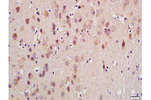 Formalin-fixed and paraffin embedded rat brain labeled with Anti-GnRHR Polyclonal Antibody, Unconjugated  at 1:200 followed by conjugation to the secondary antibody and DAB staining