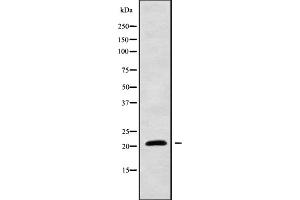 Western blot analysis of CYBA using HeLa whole cell lysates (CYBA anticorps  (N-Term))