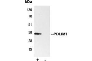 Immunoprecipitation of PDLIM1 from 0.