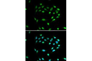 Immunofluorescence analysis of A549 cell using SIRT1 antibody. (SIRT1 anticorps)