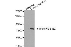 Western Blotting (WB) image for anti-Myristoylated Alanine-Rich Protein Kinase C Substrate (MARCKS) (pSer162) antibody (ABIN1870417) (MARCKS anticorps  (pSer162))