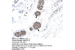 Human urinary bladder (MMP19 anticorps  (N-Term))
