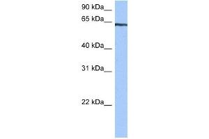TTC6 antibody used at 0. (TTC6 anticorps  (C-Term))