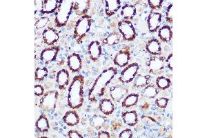Immunohistochemistry of paraffin-embedded rat kidney using PDH Rabbit pAb (7432) at dilution of 1:100 (40x lens). (PDHA1 anticorps)
