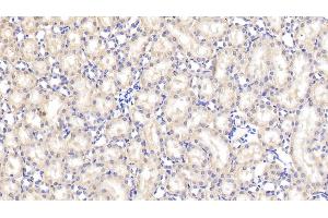 Detection of vHL in Rat Kidney Tissue using Polyclonal Antibody to Von Hippel Lindau Tumor Suppressor (vHL)