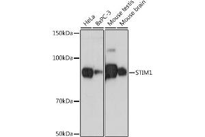 Western blot analysis of extracts of various cell lines, using STIM1 antibody (ABIN7270609) at 1:500 dilution. (STIM1 anticorps)