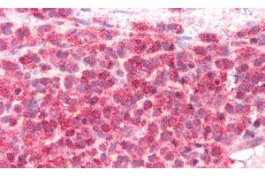 Detection of ICOSLG in Human Spleen Tissue using Polyclonal Antibody to Inducible T-Cell Co Stimulator Ligand (ICOSLG)