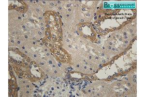 Formalin-fixed and paraffin embedded rat kidney labeled with Anti- HSD11B2 Polyclonal Antibody, Unconjugated at 1:200 followed by conjugation to the secondary antibody and DAB staining