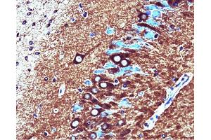 Catalytic alpha (clone 46) staining on rat brain. (PP2A Catalytic alpha (AA 153-309) anticorps)