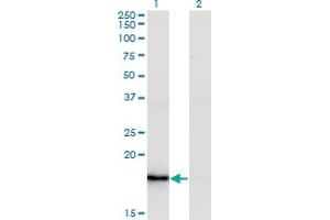 Western Blot analysis of ZMAT4 expression in transfected 293T cell line by ZMAT4 monoclonal antibody (M02), clone 2A4.