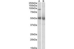 AP31417PU-N USP6 antibody staining of Human Placenta lysate at 2 µg/ml (35 µg protein in RIPA buffer) with (B) and without (A) blocking with the immunizing peptide. (USP6 anticorps  (C-Term))