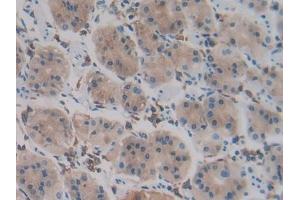 Detection of PCPE2 in Human Stomach Tissue using Polyclonal Antibody to Procollagen C Proteinase Enhancer 2 (PCPE2)