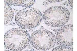 IHC-P analysis of Mouse Testis Tissue, with DAB staining. (GNRH1 anticorps  (AA 22-90))