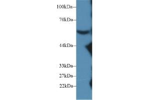 Western blot analysis of Mouse Serum, using Mouse C8b Antibody (2 µg/ml) and HRP-conjugated Goat Anti-Rabbit antibody ( (C8B anticorps  (AA 161-503))