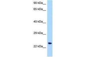 Image no. 1 for anti-Osteoclast Associated Receptor (OSCAR) (C-Term) antibody (ABIN6748008) (OSCAR anticorps  (C-Term))