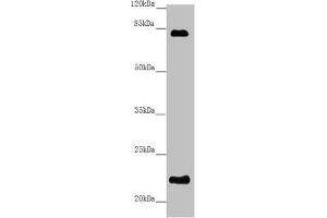 Western blot All lanes: REEP1 antibody at 5. (Receptor Accessory Protein 1 anticorps  (AA 101-201))
