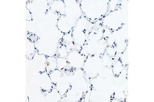 Immunohistochemistry of paraffin-embedded mouse lung using YE Rabbit pAb (ABIN6130808, ABIN6150331, ABIN6150332 and ABIN6221925) at dilution of 1:100 (40x lens). (GAS41 anticorps  (AA 1-227))
