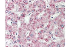 Image no. 1 for anti-Peroxisomal Trans-2-Enoyl-CoA Reductase (PECR) (AA 241-302) antibody (ABIN467560)