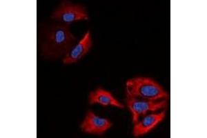 Immunofluorescent analysis of Beta-actin staining in A549 cells.
