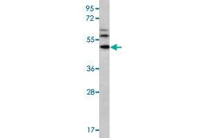 Western blot analysis of MDA-MB-435 cell lysate (35 ug/lane) with MMP16 polyclonal antibody . (MMP16 anticorps  (N-Term))