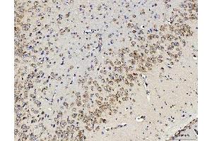 IHC analysis of RPL10 using anti-RPL10 antibody (ABIN7601177).