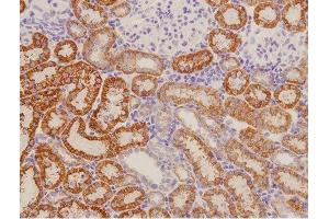 This image was generously provided by Xi Qiao from the Second Hospital of Shanxi Medical University. (RAMP1 anticorps  (AA 118-148))