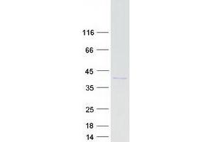 Validation with Western Blot