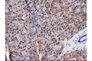 Image no. 14 for anti-Destrin (Actin Depolymerizing Factor) (DSTN) antibody (ABIN1497907)