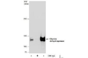 IP Image Immunoprecipitation of Glycine dehydrogenase protein from HepG2 whole cell extracts using 5 μg of Glycine dehydrogenase antibody [N3C2-2], Internal, Western blot analysis was performed using Glycine dehydrogenase antibody [N3C2-2], Internal, EasyBlot anti-Rabbit IgG  was used as a secondary reagent.