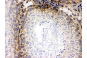 IHC analysis of CRM1 using anti-CRM1 antibody .