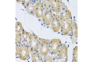 Immunohistochemistry of paraffin-embedded human stomach using DYNC1I1 antibody. (DYNC1I1 anticorps  (AA 1-220))