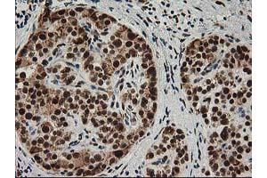 Image no. 14 for anti-Excision Repair Cross-Complementing Rodent Repair Deficiency, Complementation Group 4 (ERCC4) antibody (ABIN1498070)