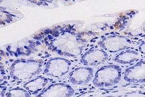 Immunohistochemistry analysis of paraffin-embedded rat colon using,FGF10 (ABIN7073940) at dilution of 1: 8000