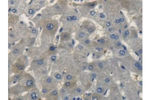 DAB staining on IHC-P; Samples: Human Liver Tissue (NPPC anticorps  (AA 33-125))