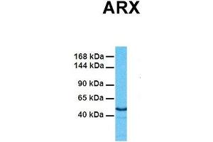 Host:  Rabbit  Target Name:  ARX  Sample Tissue:  Human Fetal Heart  Antibody Dilution:  1. (Arx anticorps  (Middle Region))
